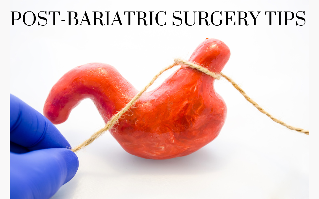 Four Tips for Adapting to Life After Bariatric Surgery